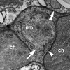 nucleomorph 